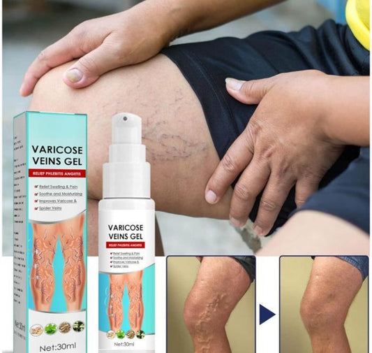 Varicose Veins Gel (Pack of 1)