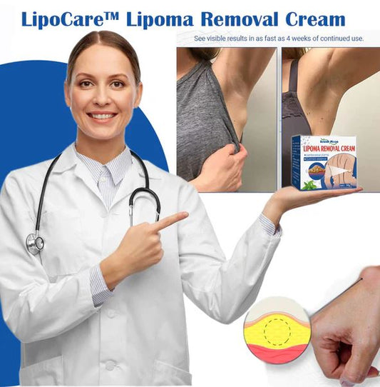Doctor's No 1 choice | Lipoma Removal Cream (Pack of 2)
